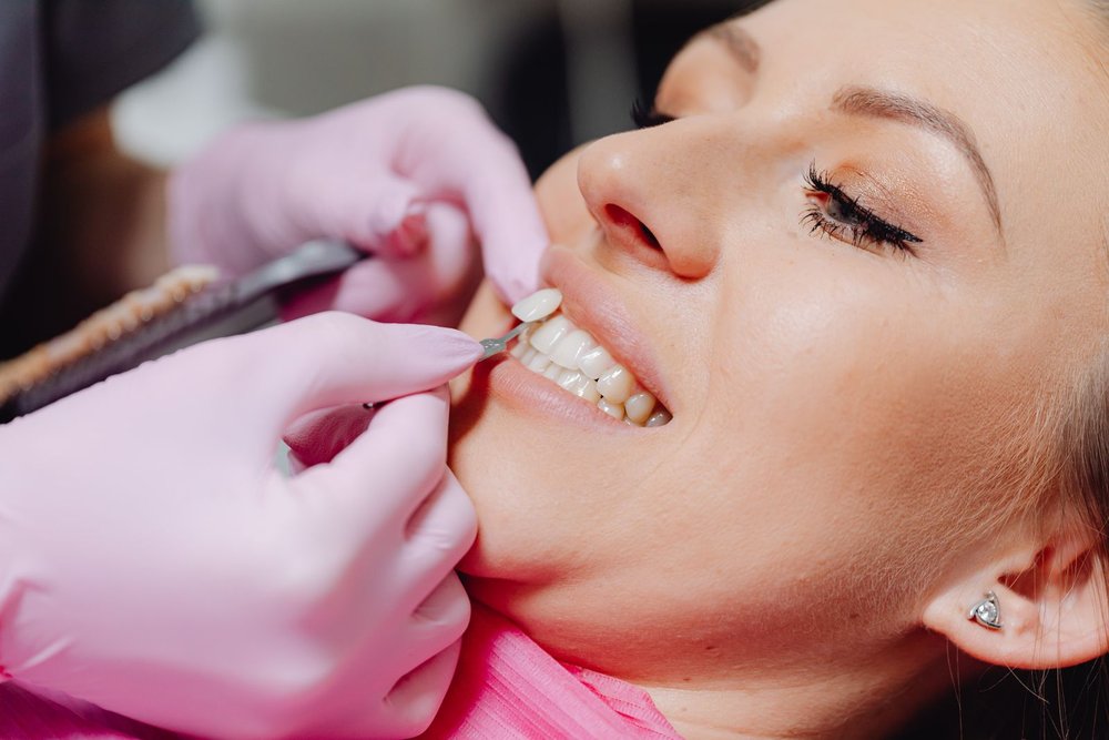 Comment entretenir son sourire après un blanchiment ?